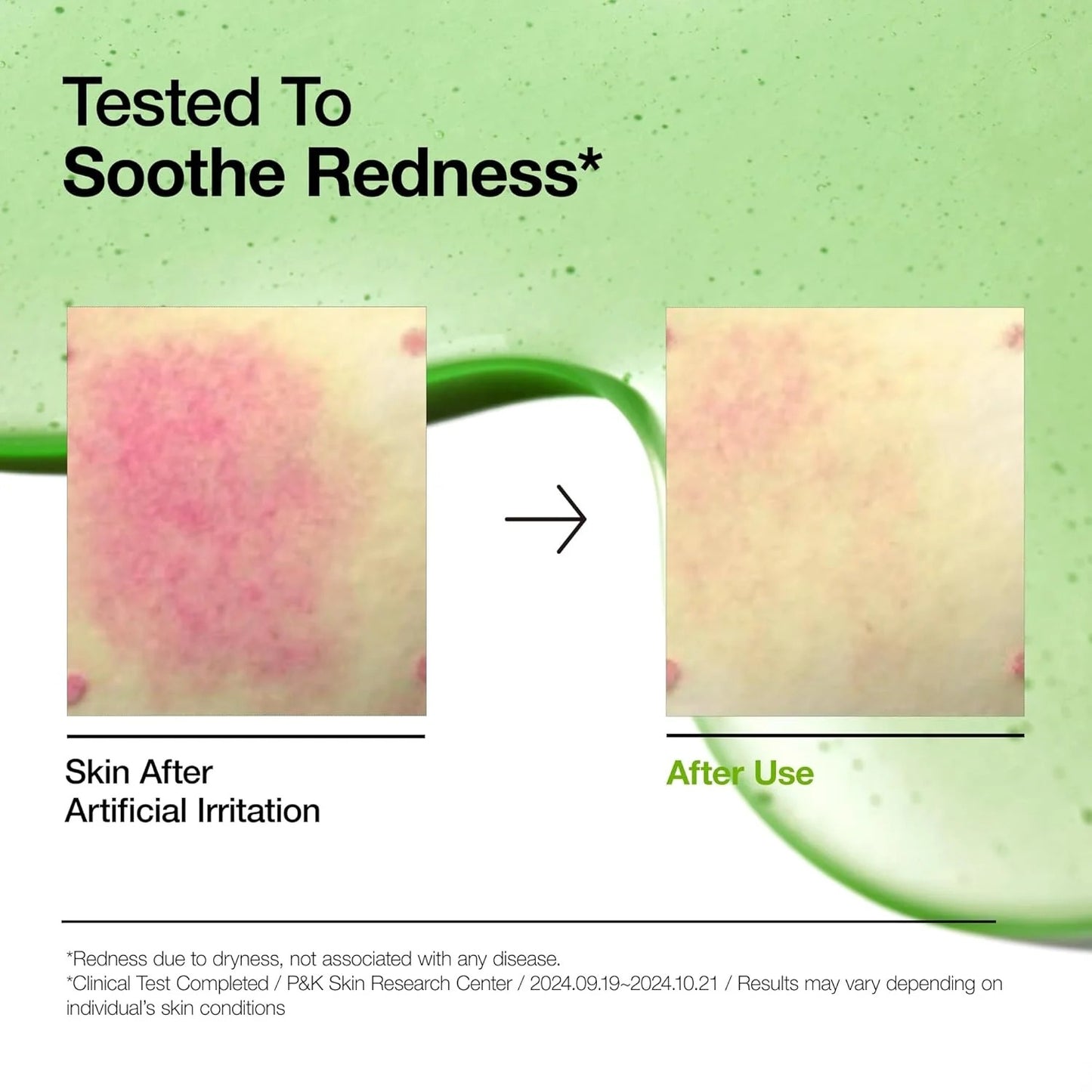Anua Niacinamide + TXA Serum – Skin Brightening & Tone Correcting Treatment