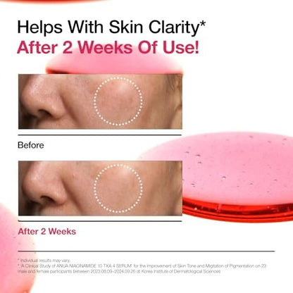 Anua Niacinamide + TXA Serum – Skin Brightening & Tone Correcting Treatment