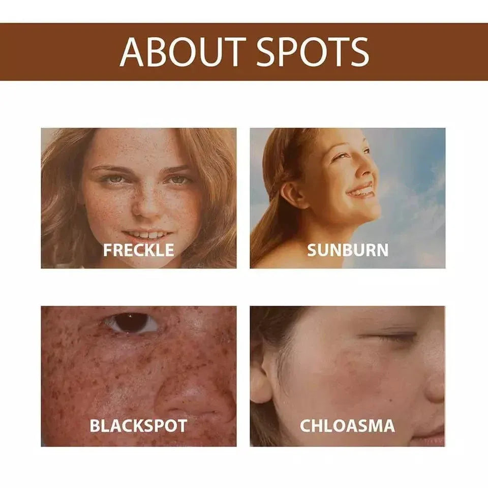 Glow Boost Anti-Freckle Serum