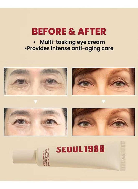 SEOUL 1988 Eye Cream – Anti-Aging Eye Care for Dark Circles & Wrinkles